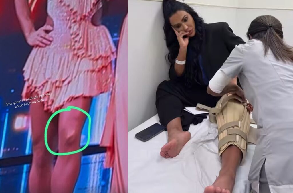 Gracyanne Barbosa fala sobre pausa após lesão no joelho: ‘Hoje começo a dança da recuperação’
